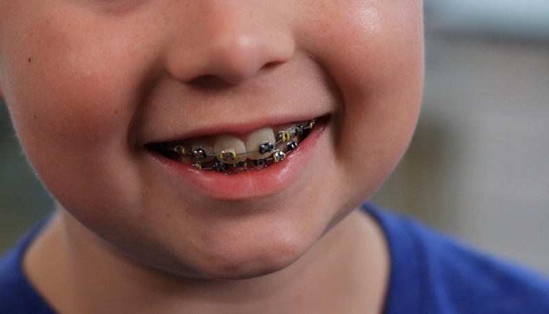 خدمات ارتودنسی دندان شهرکرد