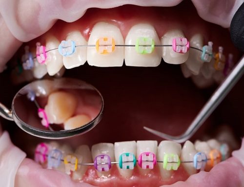 قبل از شروع ارتودنسی چه سؤالاتی باید بپرسیم؟ | پاسخ‌های تخصصی برای انتخاب بهترین متخصص ارتودنسی در شهرکرد