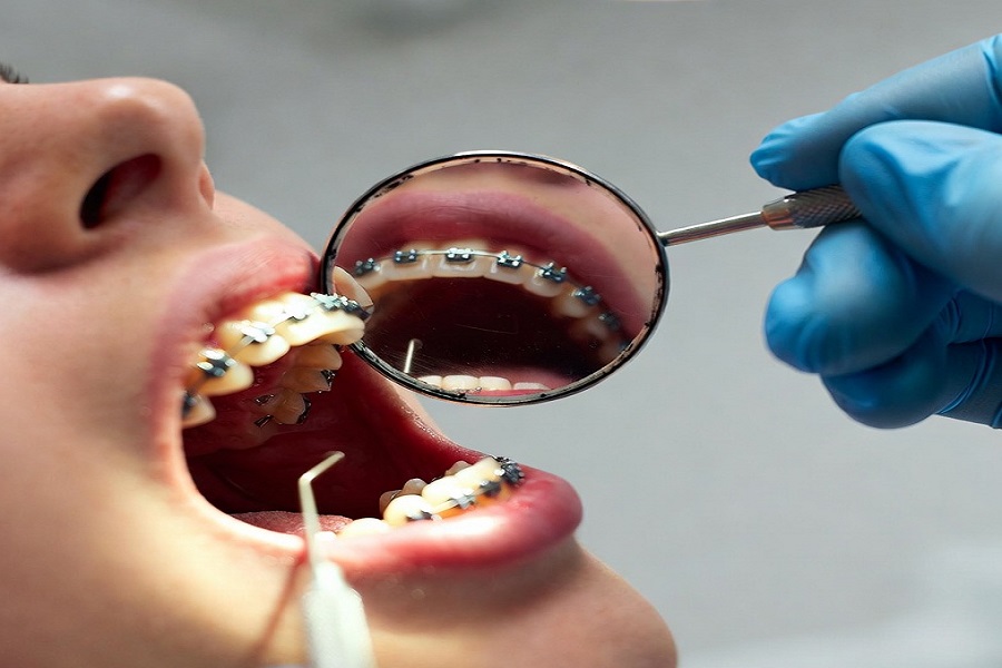 خدمات ارتودنسی در شهرکرد