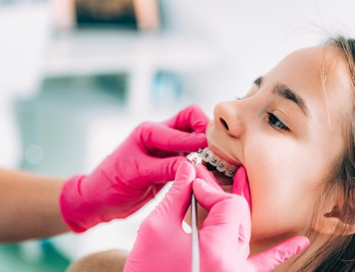 ارتودنسی کودکان و نوجوانان در شهرکرد | پاسخ به مهم‌ترین سؤالات والدین قبل از انتخاب متخصص ارتودنسی