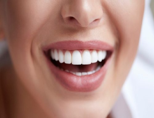 هزینه ارتودنسی در شهرکرد