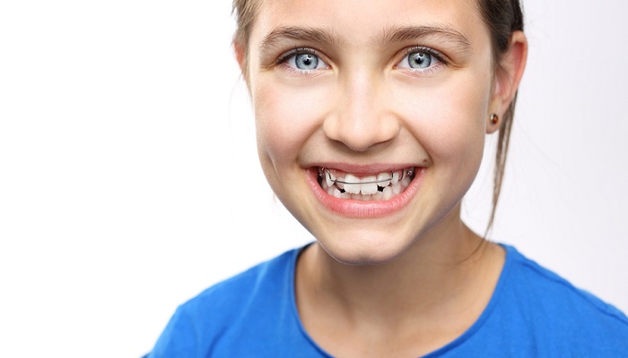 ارتودنسی متحرک