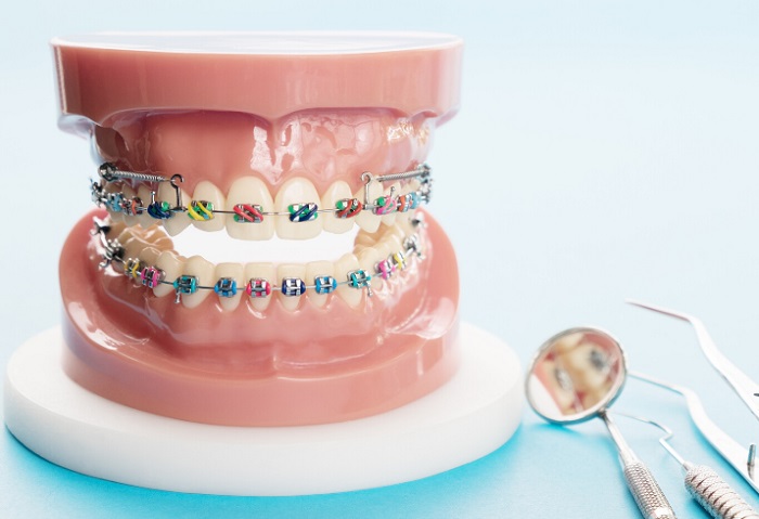 ارتودنسی دندان