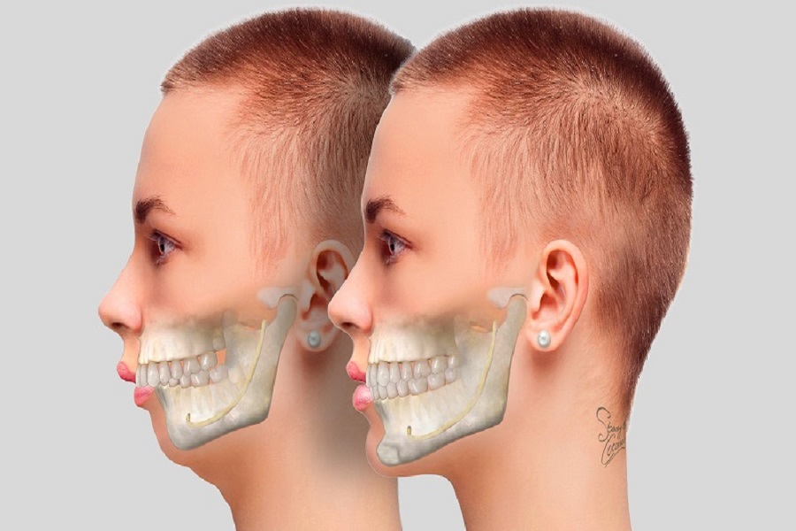 ناهنجاری فکی در شهرکرد