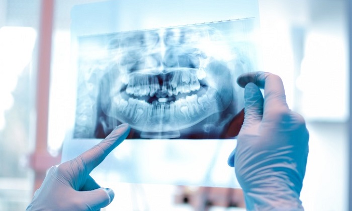 مراحل ارتودنسی